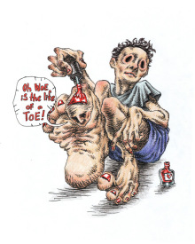 Toe-Woes